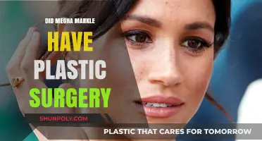 Meghan Markle's Transformation: Plastic Surgery Speculations and Facts Revealed