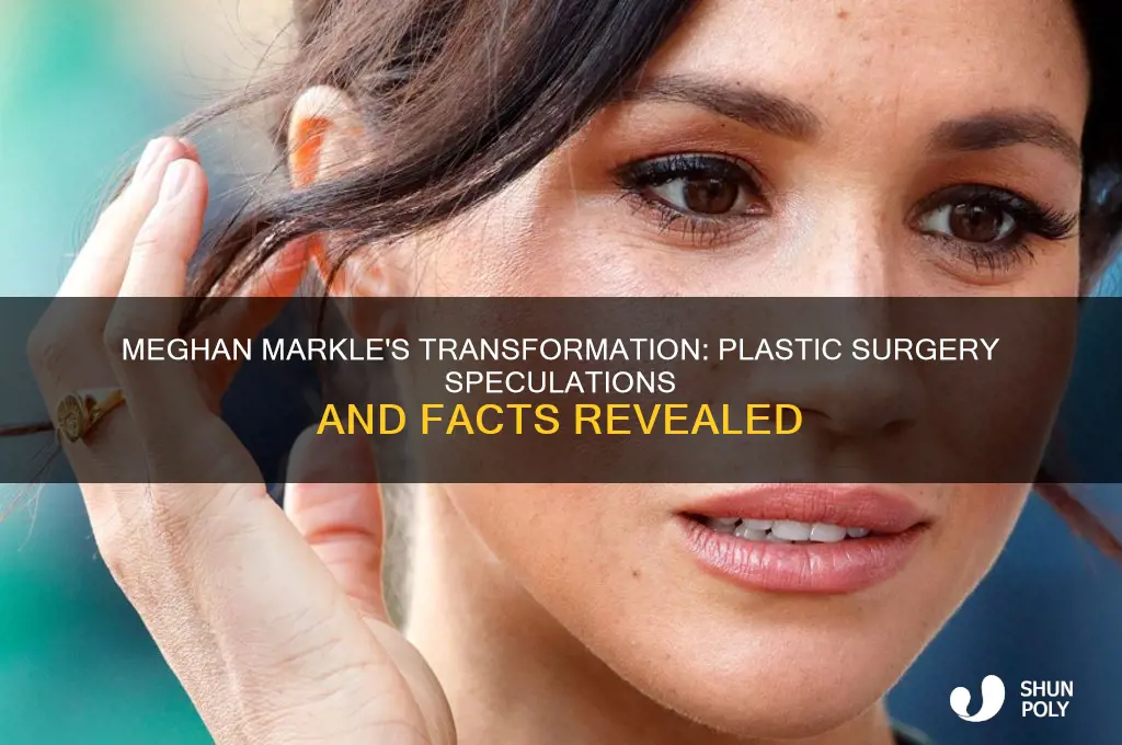 did megha markle have plastic surgery