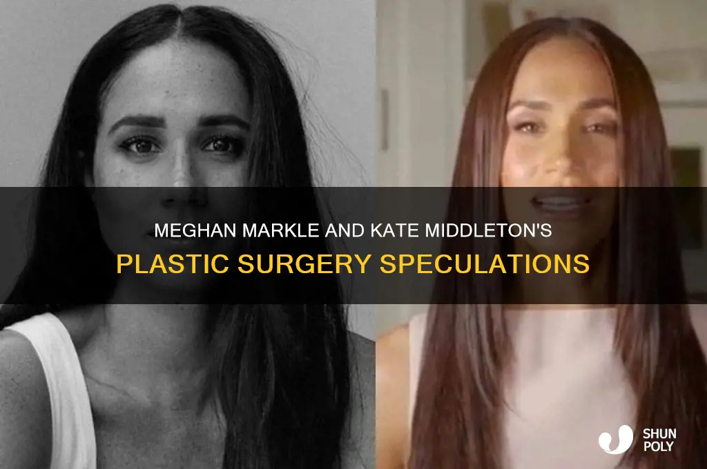 did meghan and kate middleton have plastic surgeon