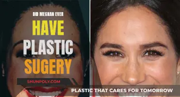 The Truth About Meghan's Plastic Surgery Speculation