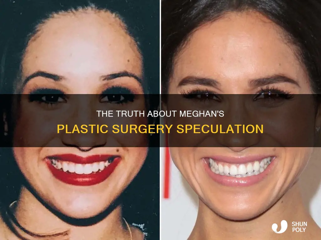 did meghan ever have plastic sugery