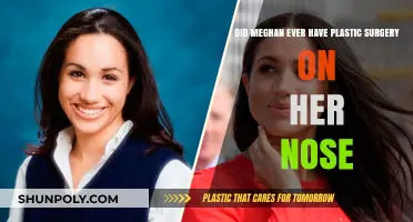 Meghan Markle's Nose: Natural Beauty or Plastic Surgery?