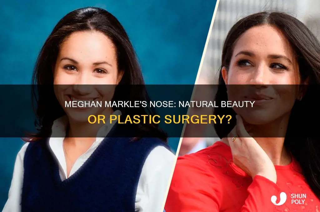 did meghan ever have plastic surgery on her nose