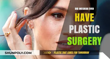 Meghan Markle's Transformation: Plastic Surgery Rumors Explored and Debunked