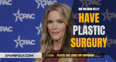 Meghan Kelly's Plastic Surgery: What's the Truth?