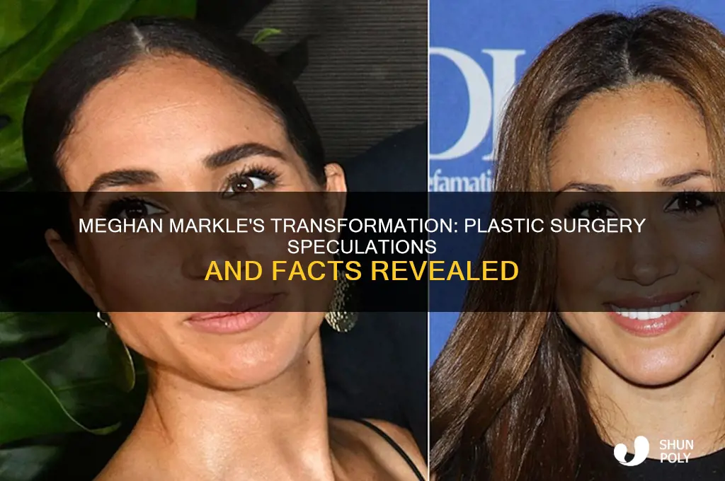 did meghan markle have plastic surgery