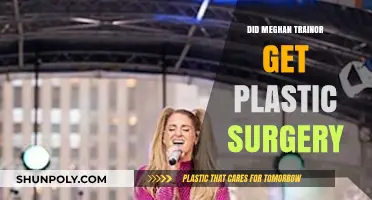 Meghan Trainor Plastic Surgery: Fact-Checking Her Transformation Rumors
