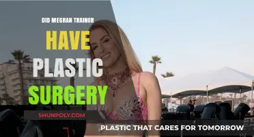 Meghan Trainor Plastic Surgery: Fact-Checking the Transformation Rumors