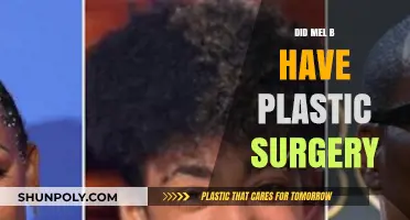 Mel B's Transformation: Plastic Surgery Rumors and Reality Revealed
