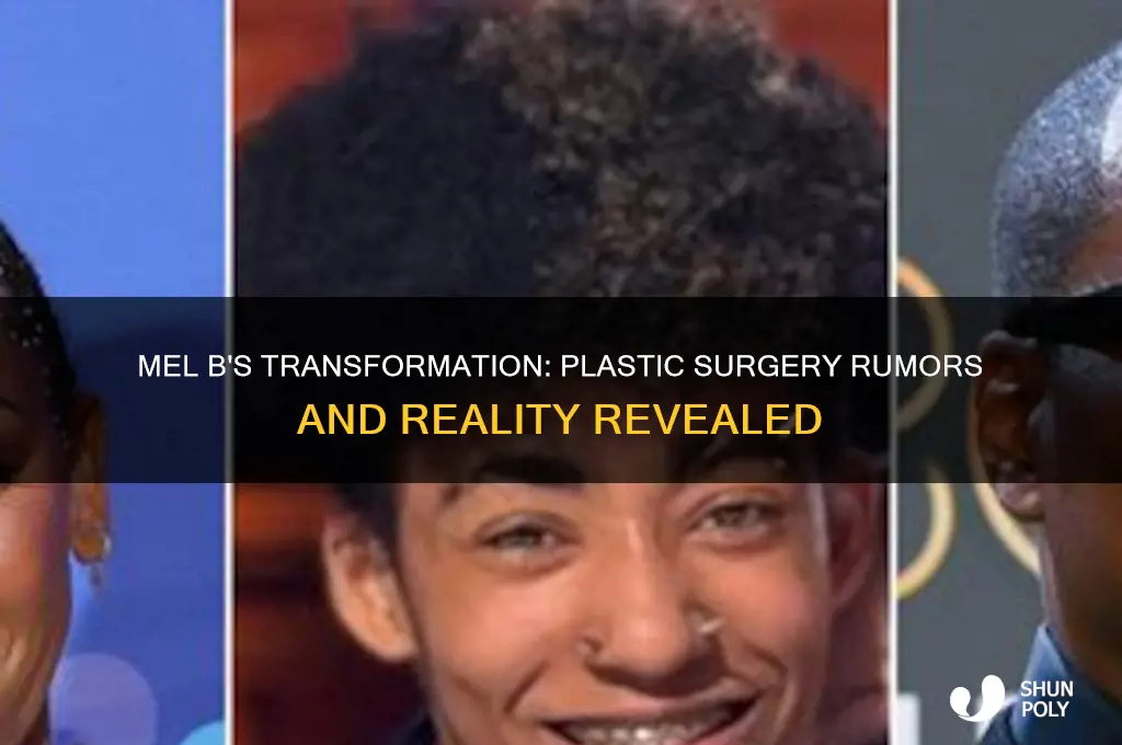 did mel b have plastic surgery