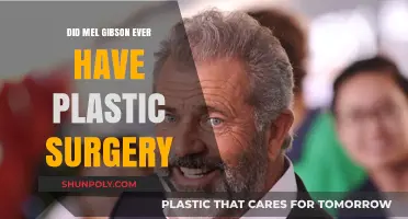 Mel Gibson's Transformation: Plastic Surgery Rumors Explored and Debunked