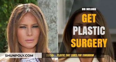Melania Trump's Transformation: Plastic Surgery Speculations and Truths Revealed