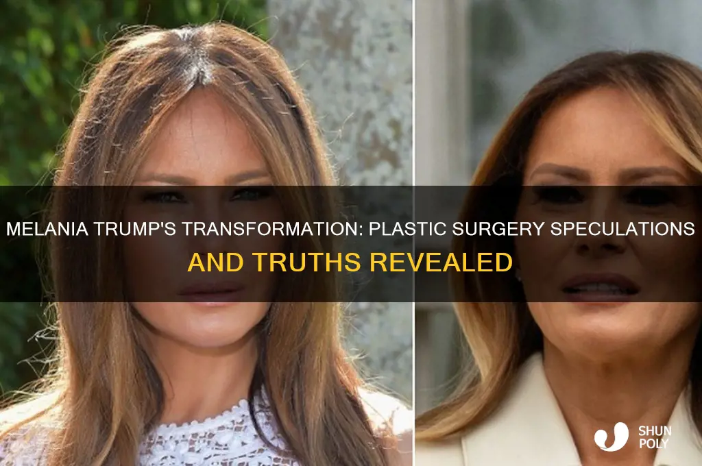 did melania get plastic surgery
