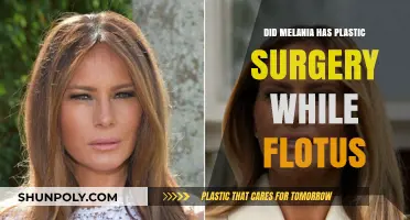 Melania Trump's FLOTUS Transformation: Plastic Surgery Speculations Explored