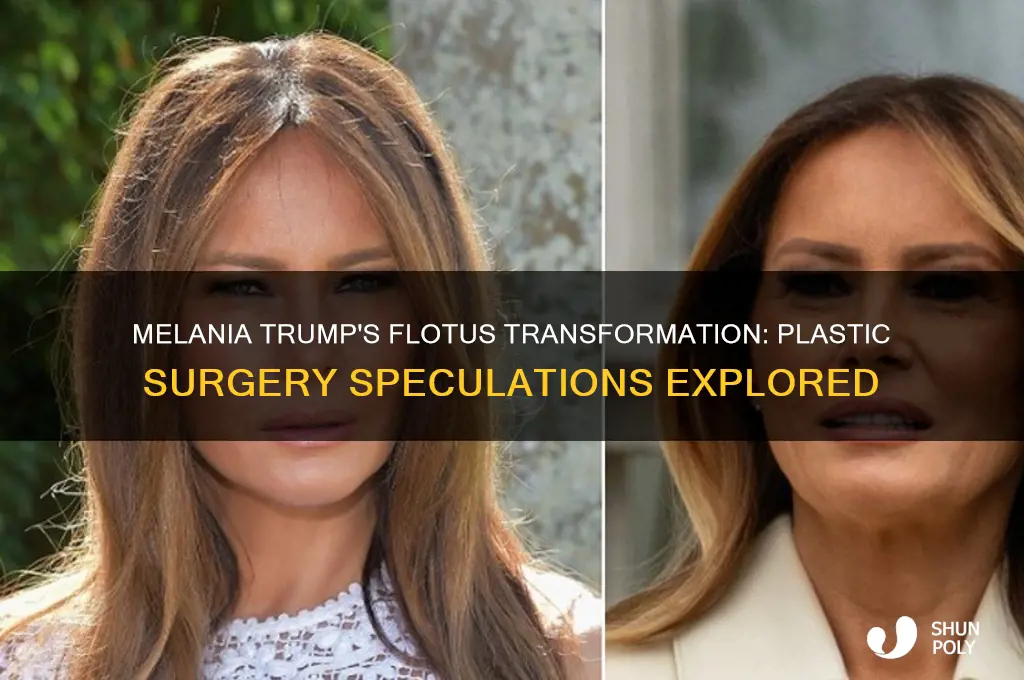 did melania has plastic surgery while flotus