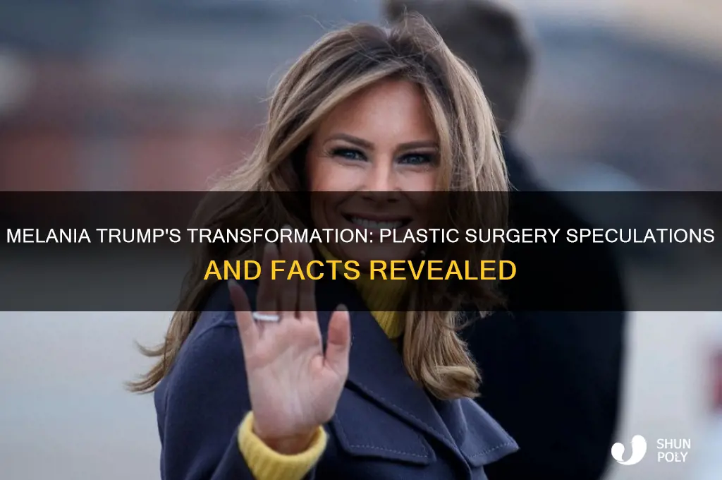 did melania have plastic surgery
