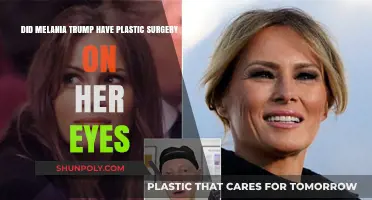 Melania Trump's Eye Transformation: Plastic Surgery Speculations Explored