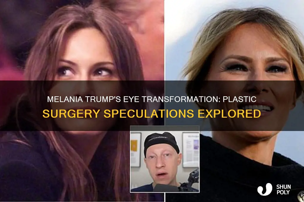 did melania trump have plastic surgery on her eyes