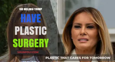 Melania Trump's Transformation: Plastic Surgery Speculations and Facts Revealed