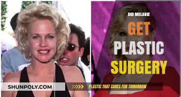 Melanie's Transformation: Plastic Surgery Rumors and the Truth Revealed