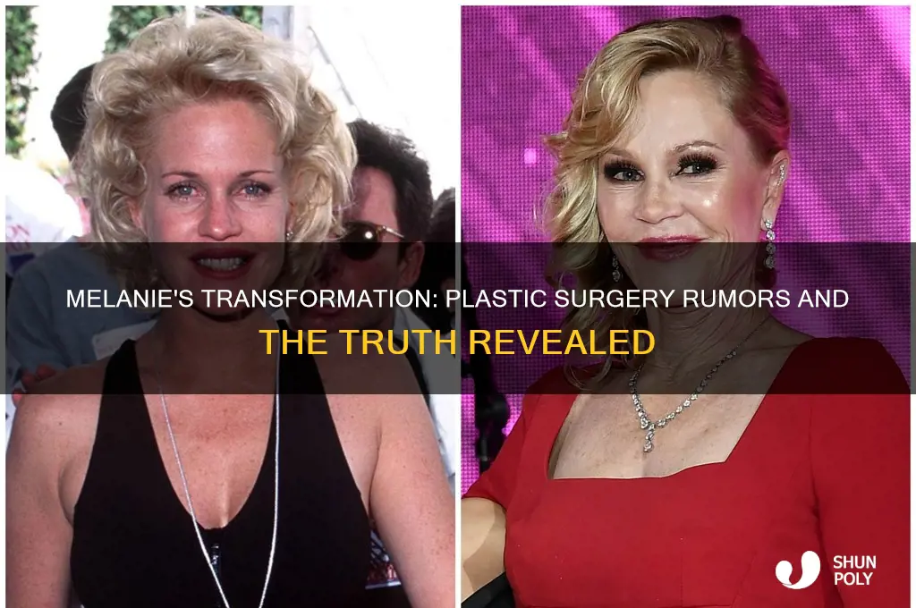 did melanie get plastic surgery