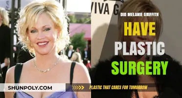 Melanie Griffith's Transformation: Plastic Surgery Rumors and Reality Revealed
