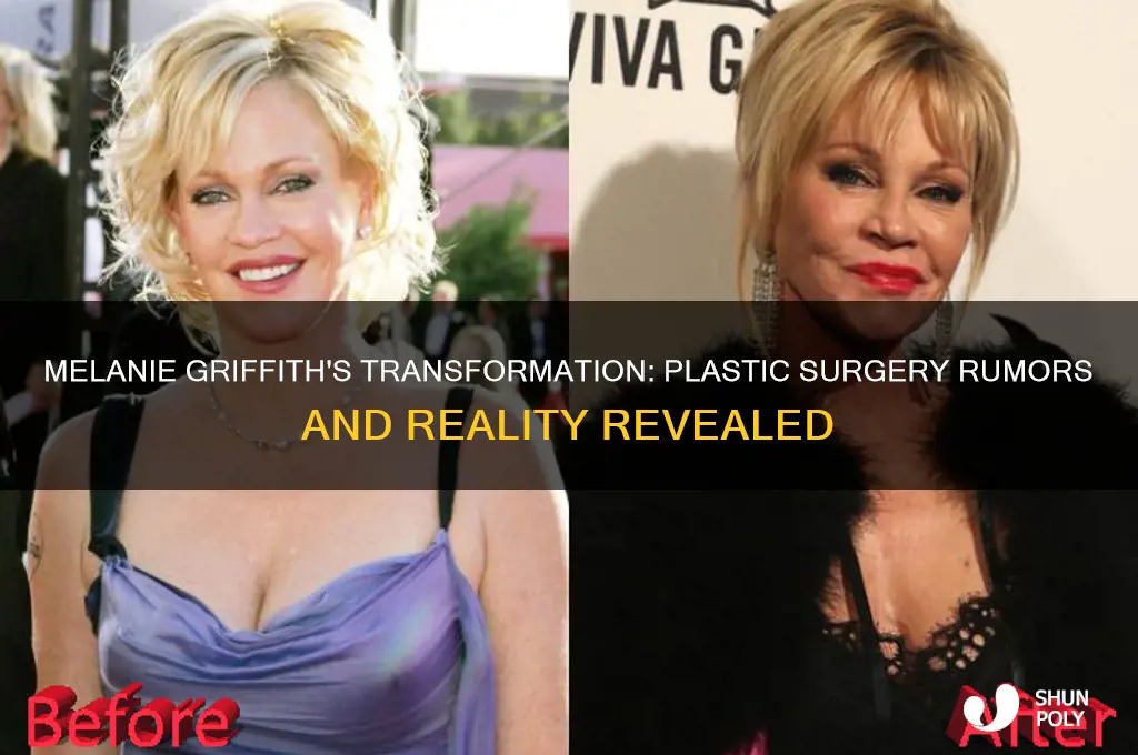 did melanie griffith have plastic surgery