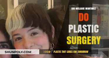 Melanie Martinez Plastic Surgery: Fact-Checking the Rumors and Speculations