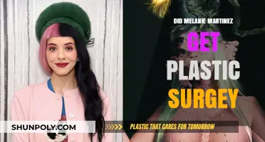 Melanie Martinez Plastic Surgery: Fact-Checking the Transformation Rumors