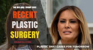 Melania Trump's Recent Appearance Sparks Plastic Surgery Speculations