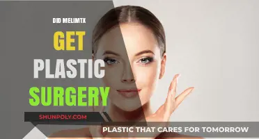 Did Melimtx Undergo Plastic Surgery? Unveiling the Truth Behind the Rumors