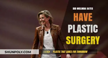 Melinda Gates Plastic Surgery: Fact-Checking the Rumors and Speculations