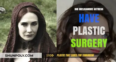 Melisandre Actress Plastic Surgery: Fact-Checking Carice van Houten's Transformation