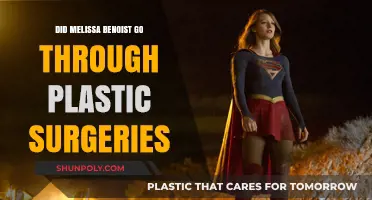 Melissa Benoist's Transformation: Plastic Surgery Rumors Explored and Debunked
