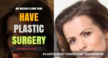 Melissa Claire Egan's Transformation: Plastic Surgery Speculations Explored