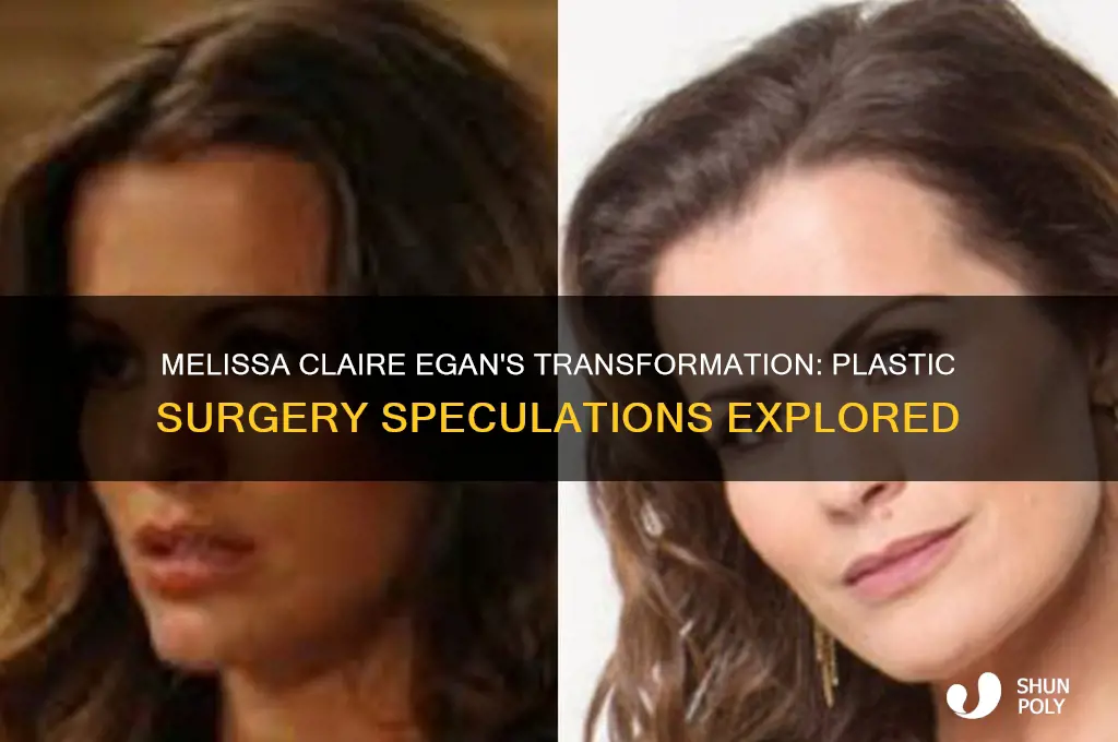did melissa claire egan have plastic surgery