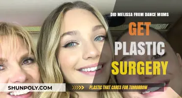 Melissa from Dance Moms: Plastic Surgery Rumors and Reality