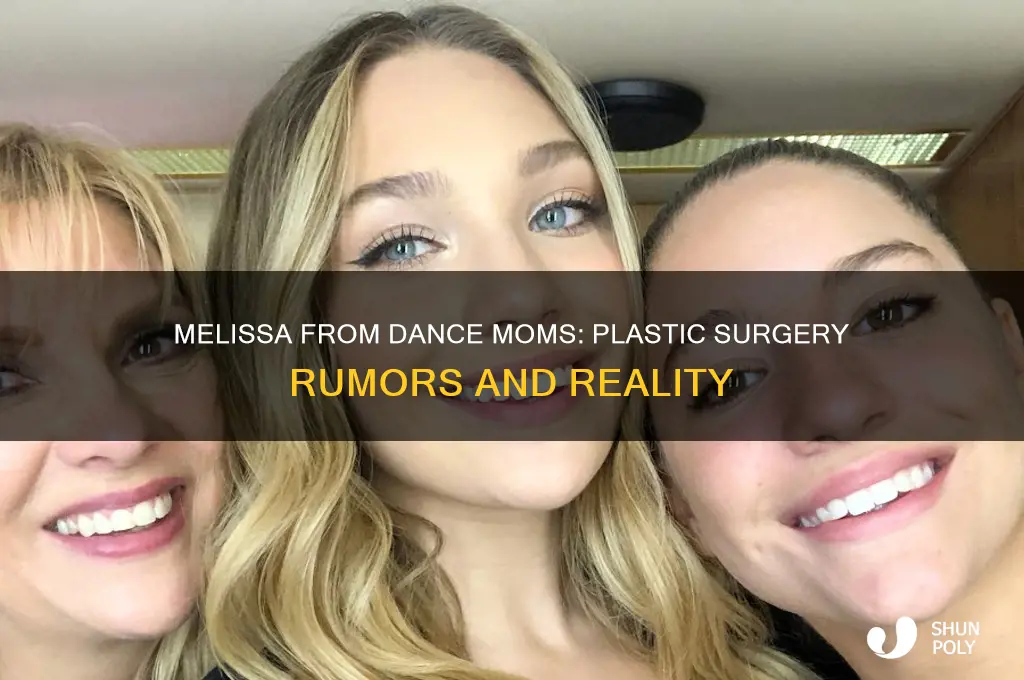 did melissa from dance moms get plastic surgery