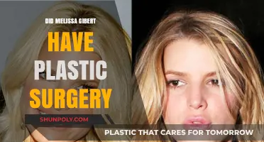 Melissa Gilbert's Transformation: Plastic Surgery Rumors Explored and Debunked