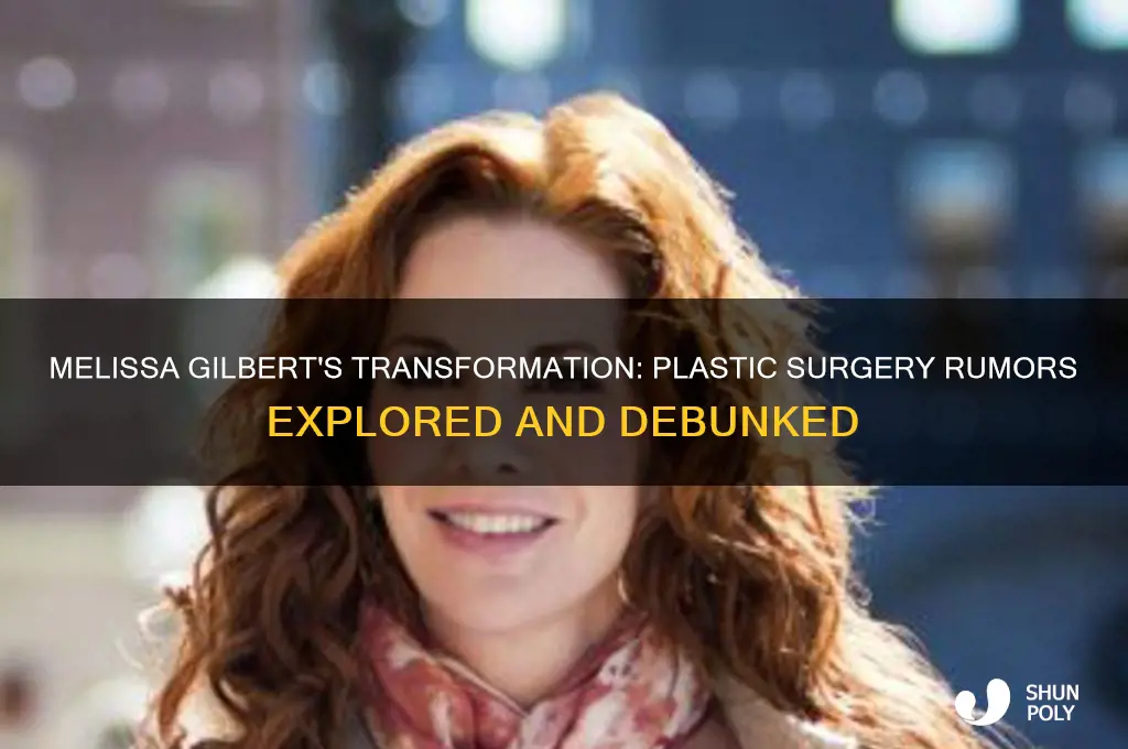 did melissa gibert have plastic surgery
