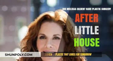 Melissa Gilbert's Transformation: Plastic Surgery Post 'Little House' Speculations