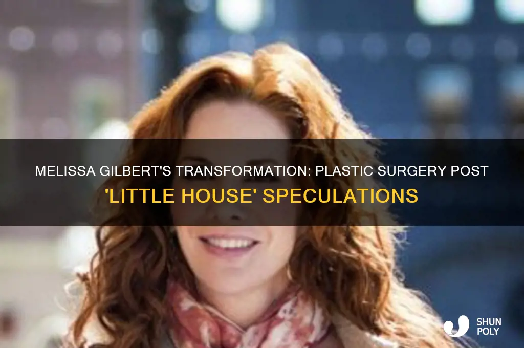 did melissa gilbert have plastic surgery after little house