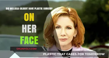 Melissa Gilbert's Facial Transformation: Plastic Surgery Speculations Explored