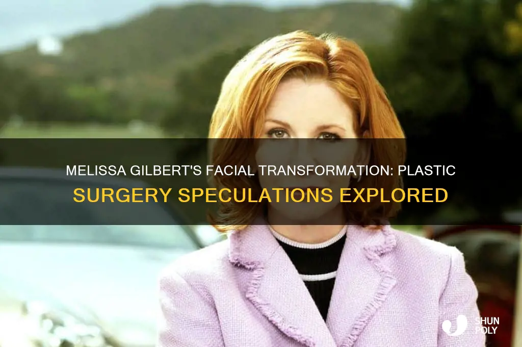did melissa gilbert have plastic surgery on her face
