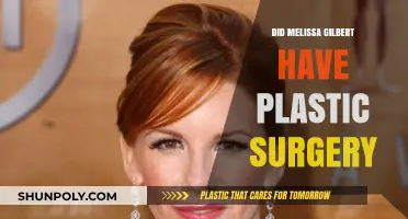Melissa Gilbert's Transformation: Plastic Surgery Rumors and Reality Revealed