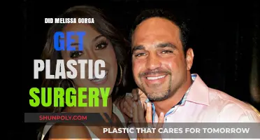 Melissa Gorga's Transformation: Plastic Surgery Rumors Explored and Debunked