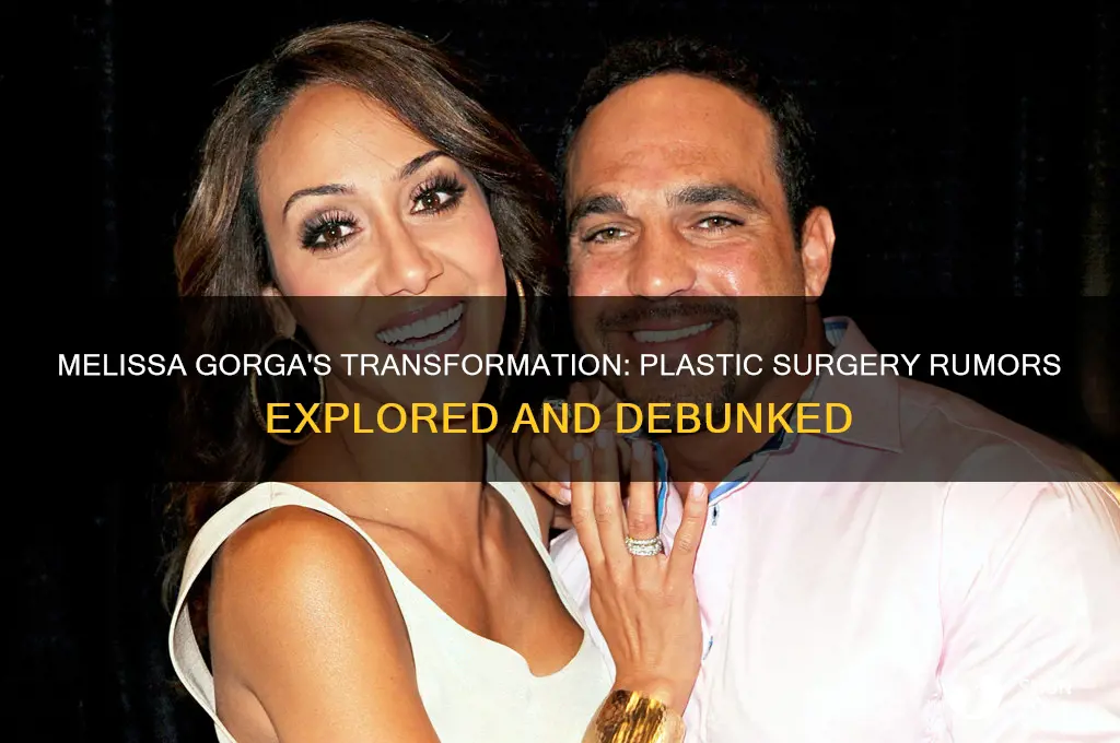 did melissa gorga get plastic surgery