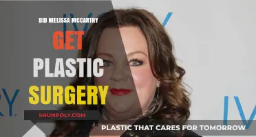 Melissa McCarthy's Transformation: Plastic Surgery Rumors Explored