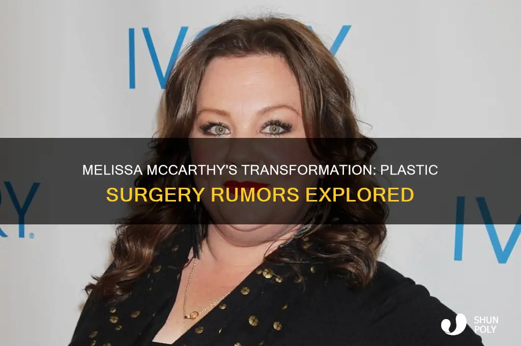 did melissa mccarthy get plastic surgery