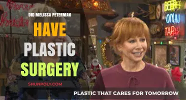 Melissa Peterman's Transformation: Plastic Surgery Speculations and Truths